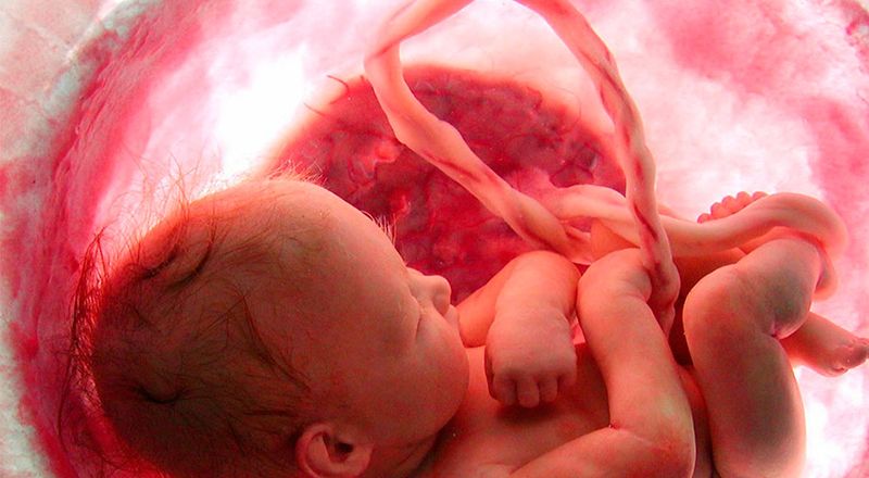 Aborto en Bolivia